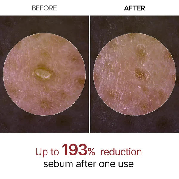 Rice Peel Glow Serum Ampoule BUY ONE GET ONE FREE!