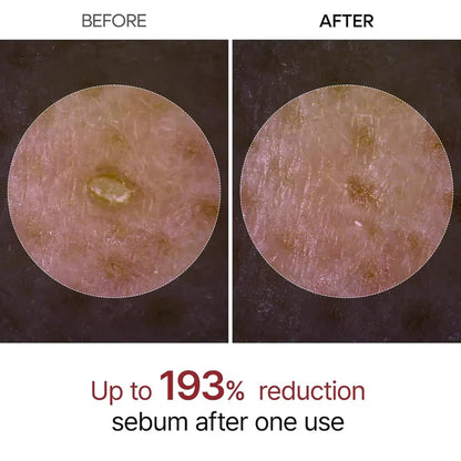 Rice Peel Glow Serum Ampoule BUY ONE GET ONE FREE!